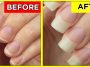 How-To-Grow-Nails-Faster-And-Stronger-6